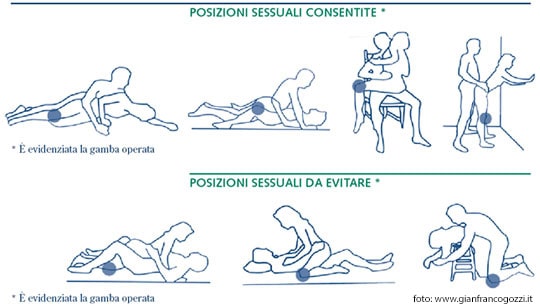 Attività Sessuale e Protesi Ginocchio