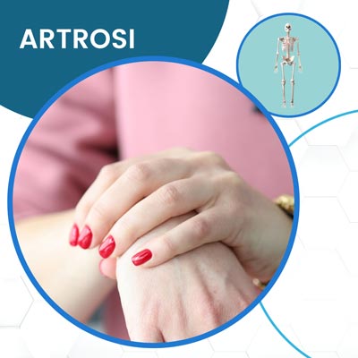 Fisioterapia per Artrosi a Roma