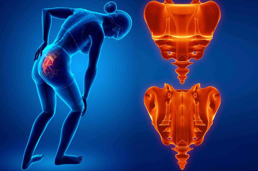 Coccigectomia Rimozione Chirurgica Del Coccige