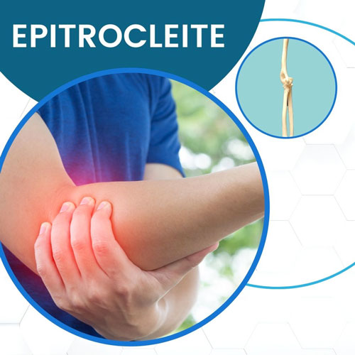 Epitrocleite o gomito del golfista