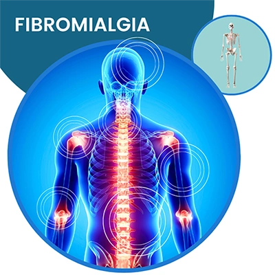 Fibromialgia
