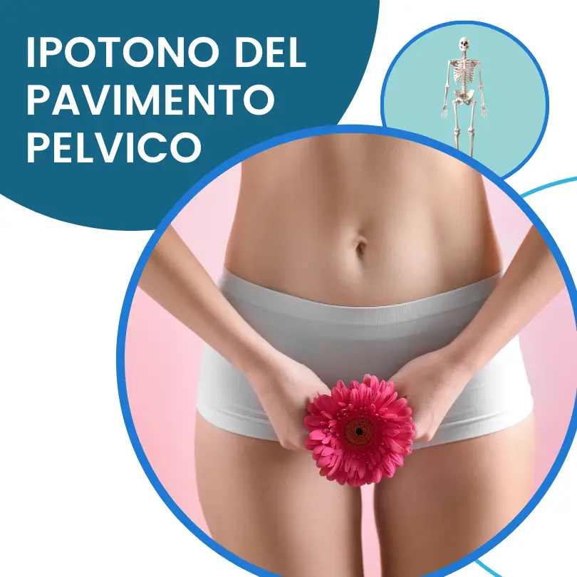 Ipotono del pavimento pelvico: conseguenze e trattamento