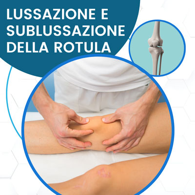 Lussazione e sublussazione della rotula