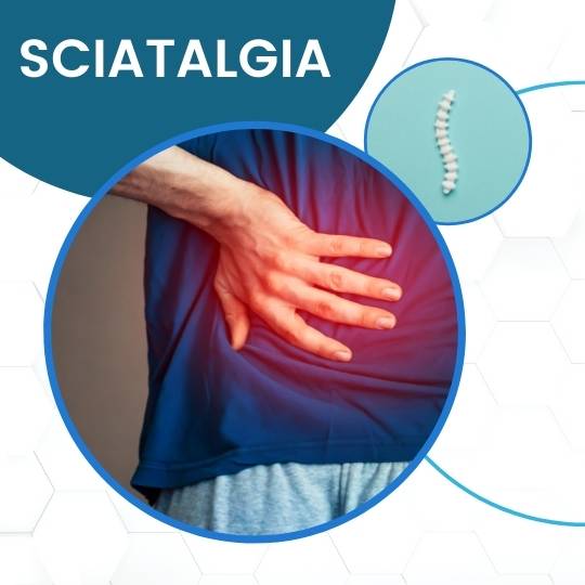 Sciatalgia