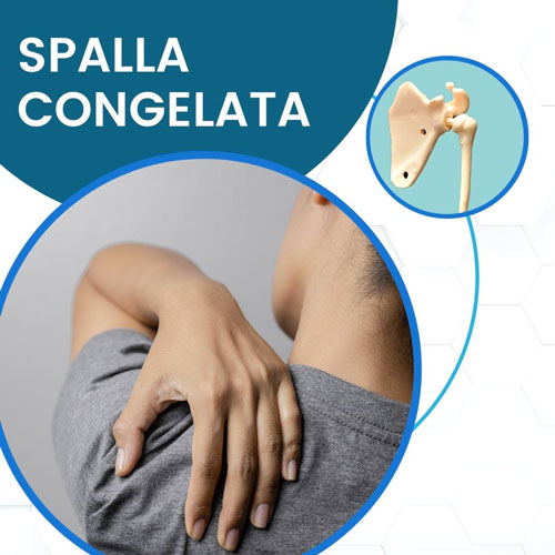 Spalla Congelata