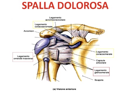 Spalla dolorosa impingement