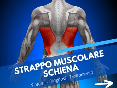 Strappo muscolare schiena