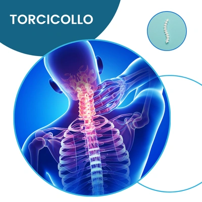 Torcicollo sintomi cause e fisioterapia a roma
