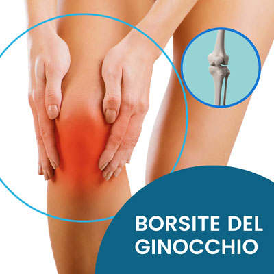 Fisioterapia per borsite ginocchio